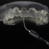 DISEÑO DE SONRISA Y LLAVE PARA CARILLAS INYECTADAS POR ARCADA