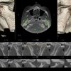 INTERPRETACION TOMOGRAFICA