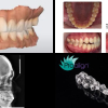 ESTUDIO CLINCHECK PROALIGN