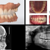 ESTUDIO ORTODONTICO 3D